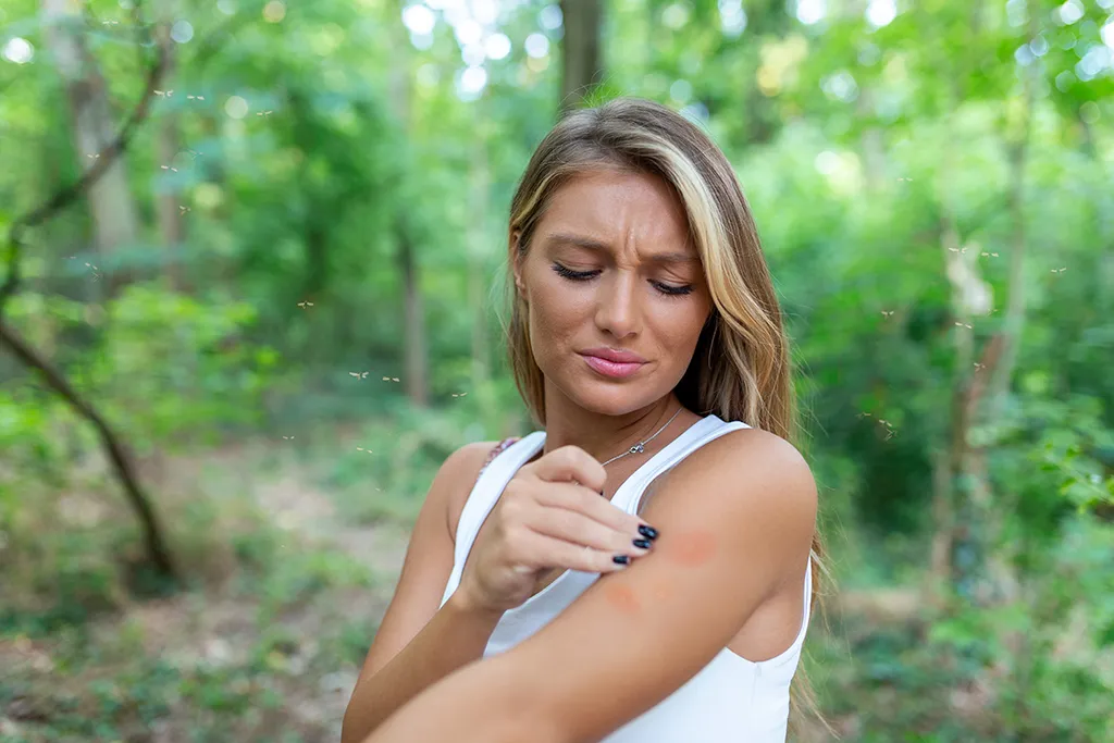 Person inspecting mosquito bites on their arm in a foresty area surrounded by mosquitoes