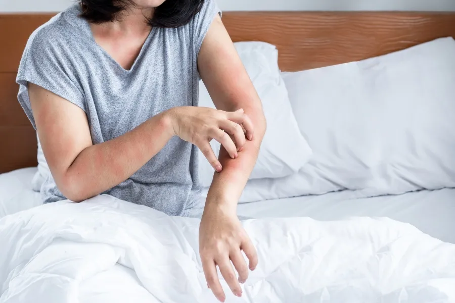 Woman sitting in bed scratching red, inflamed skin on her arm