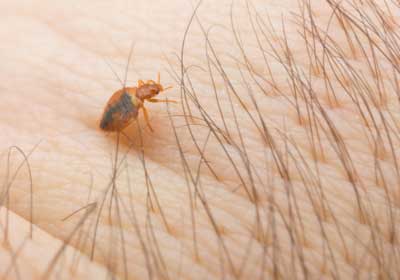 Bed bug close up on skin with hair